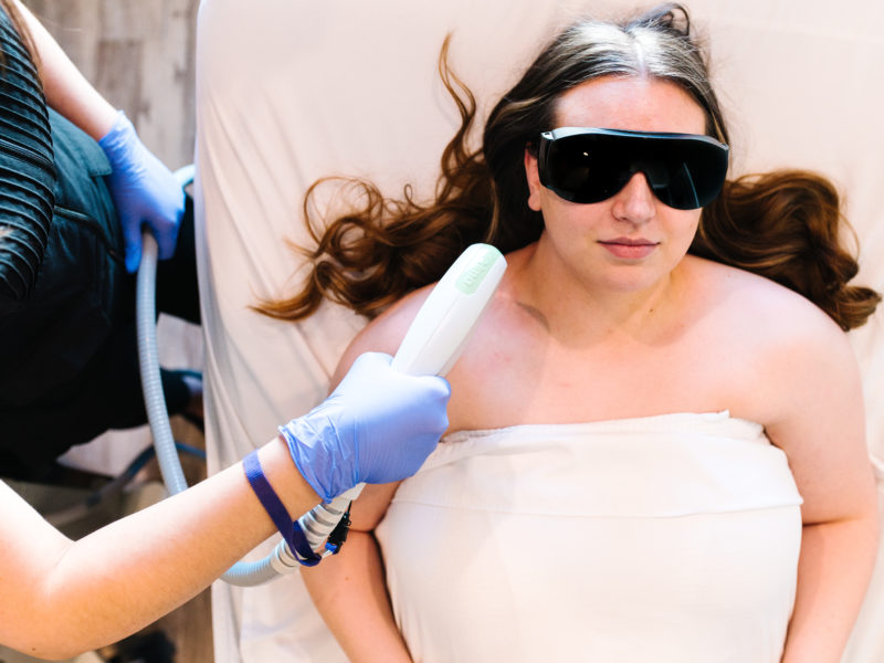Photofacial | IPL